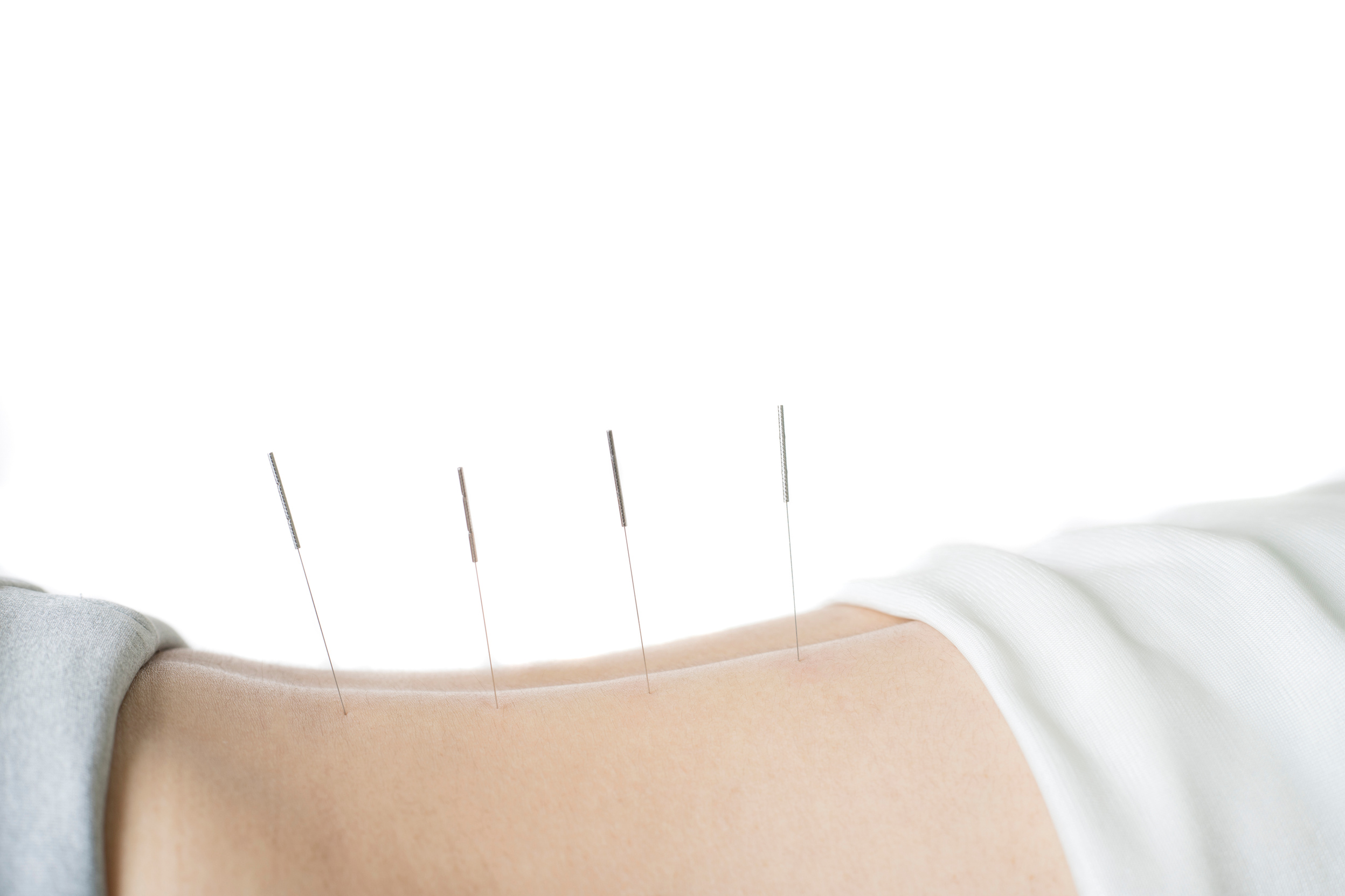 Acupuncture treatment in Asia