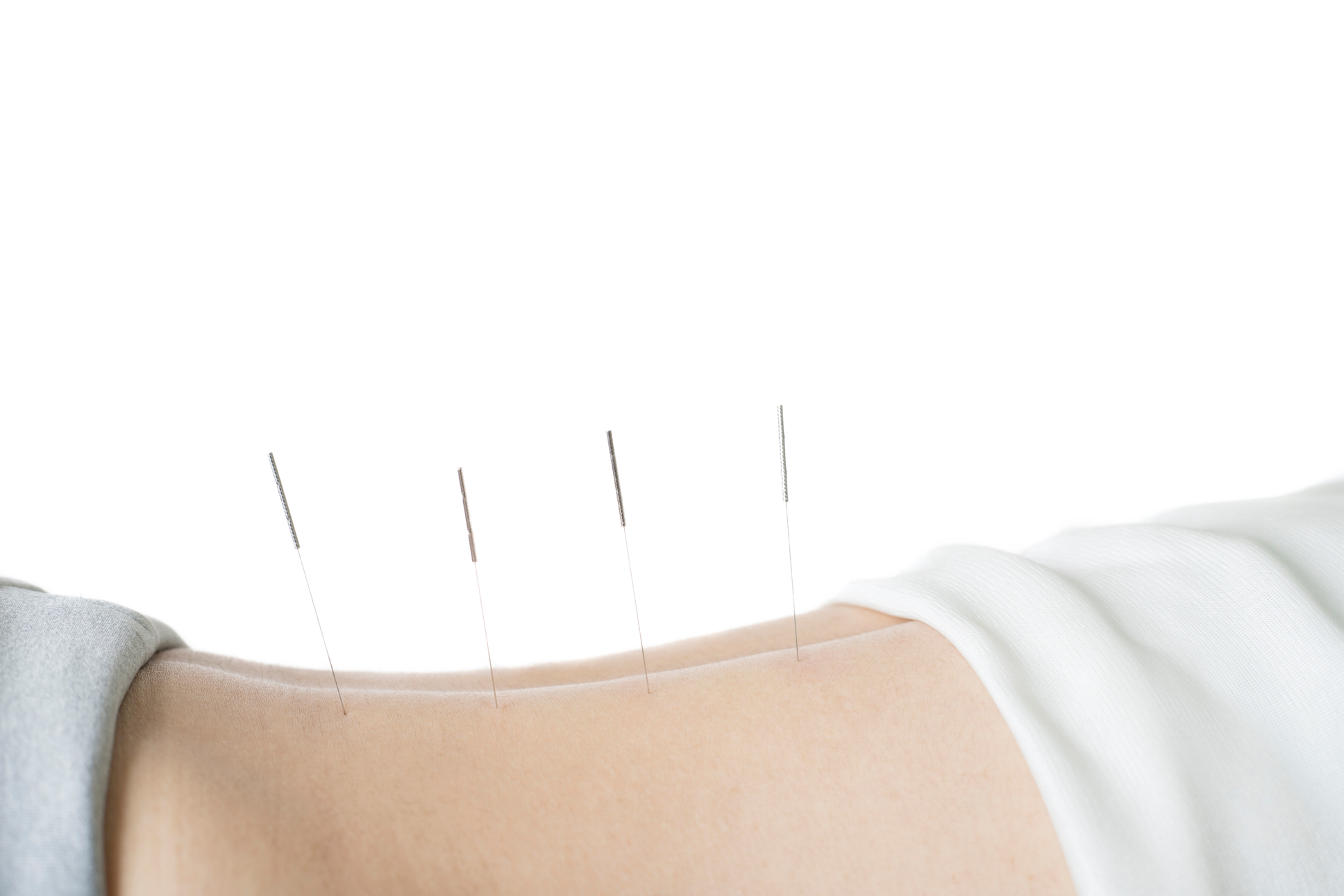 Acupuncture treatment in Asia